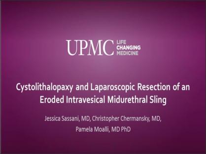 Cystolithalopaxy and Laparoscopic Resection of an Eroded Intravesical Midurethral Sling