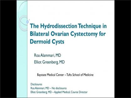 THE HYDRODISSECTION TECHNIQUE IN BILATERAL OVARIAN CYSTECTOMY FOR DERMOID CYSTS