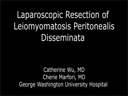 Laparoscopic Resection of Leiomyomatosis Peritonealis Disseminata