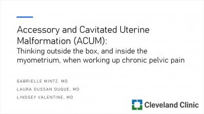 Accessory and Cavitated Uterine Malformation (ACUM): Thinking Outside the Box, and Inside the Myomet