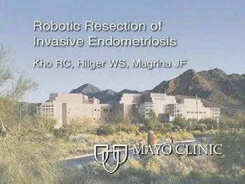 Robotic Resection of Invasive Endometriosis