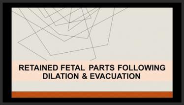 Retained Fetal Parts Following Dilation and Evacuation