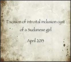 Excision of Introital Inclusion Cyst in a Sudanese Girl as a Complication of Female Genital Mutilati