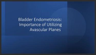 Bladder Endometriosis: The Importance of Utilizing Avascular Planes