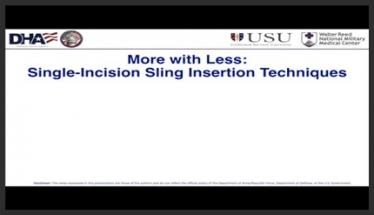 More With Less: Single-incision Sling Insertion Techniques