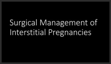 Surgical Management of Interstitial Pregnancies