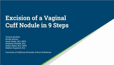 Excision of a Vaginal Cuff Nodule in 9 Steps