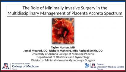 THE ROLE OF MINIMALLY INVASIVE SURGERY IN THE MULTIDISCIPLINARY MANAGEMENT OF PLACENTA ACCRETA SPECT