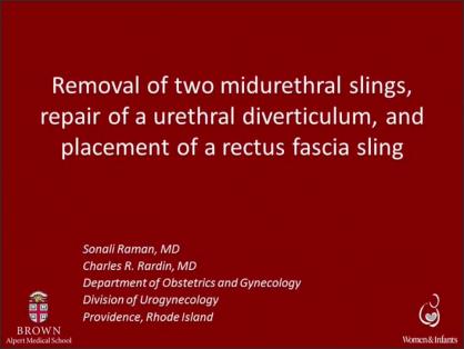 REMOVAL OF TWO MIDURETHRAL SLINGS, REPAIR OF URETHRAL DIVERTICULUM, AND PLACEMENT OF A RECTUS FASCIA